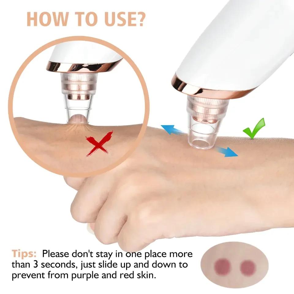 5 in 1 Multifunction Blackhead Removal Rechargeable Machine