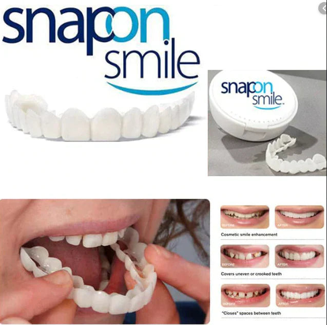 Snap on smile
